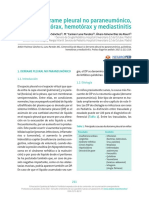 13 Derrame Pleural