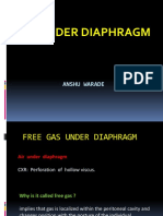 Air Under Diaphragm