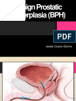 Benign Prostatic Hyperplasia (BPH) : Jeselo Ouano Gorme