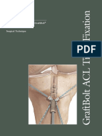 ACL Tibial Fixation Using GraftBolt Surgical Technique