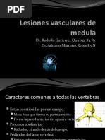 Lesiones Vasculares de Medula-100409164626-Phpapp01