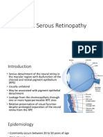 Central Serous Retinopathy