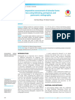 A Comparative Assessment of Alveolar Bone Loss Using Bitewing, Periapical, and Panoramic Radiography