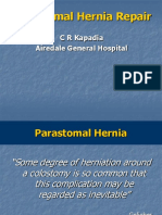 Parastomal Hernia Repair: C R Kapadia Airedale General Hospital