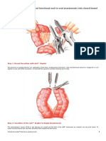 Anastomosis Intestinal