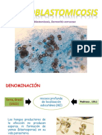 Cromoblastomicosis Seminario