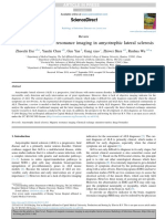 Progress of Magnetic Resonance Imaging in Amyotrophic Lateral Sclerosis