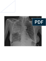 Case 1: Presentation Tachypnoeic and Febrile Patient Data AGE: 62 GENDER: Female