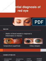 Red Eye