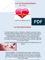 Aula 4 - NOCÕES DE ELETROCARDIOGRAMA PDF