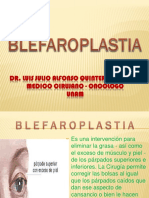 BLEFAROPLASTIA