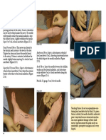 Tibial Nerve. This Nerve Is Located Posterior To The: Procedure Landmarks