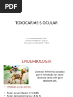 Toxocariasis Ocular