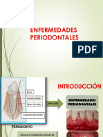 Enfermedad Periodontal