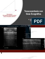 18 Toracocentesis Con Gui Üa US