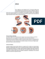 Técnicas de Cepillado