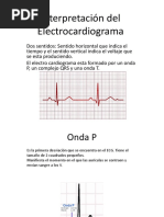 Interpretacion Del Electrocardiograma