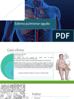 Presentación Edema Agudo Pulmón