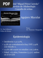 Agujero Macular