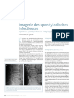 Imagerie Des Spondylodiscites Infectieuses: Mise Au Point