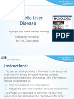 Alcoholic Live Disease