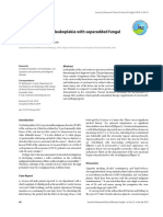 Case Report On Oral Leukoplakia With Superadded Fu