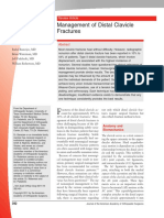 Management of Distal Clavicle Fractures