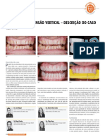 Aumento de Dimensão Vertical - Descrição Do Caso Clínico