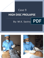 Case 9: High Disc Prolapse