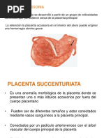 Anomalias de La Placenta