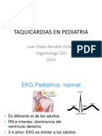 Taquicardias en Pediatría