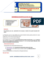 Enfermedad Diverticular de Colon