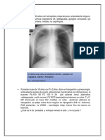 Casos Clinicos Neumonia