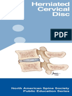 Herniated Cervical Disc