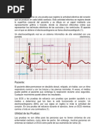 Electrocardiograma II PDF