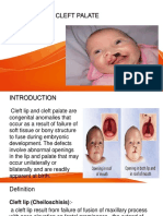 Cleft Lip and Cleft Palate