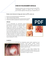 Infecciones de Transmision Sexual