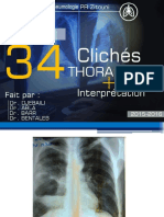 34 RX Interprétés DR BENTALEB HCA PDF