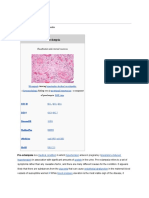 Preeclampsia