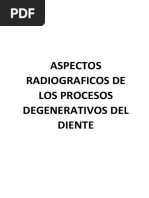 Aspectos Radiograficos de Los Procesos Degenerativos Del Diente