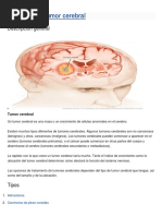 Tumor Cerebral