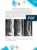 Estudio de Caso - Resonancia Magnetica