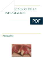 Clasificacion de La Inflamacion