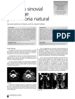 8 Sarcoma Sinovial