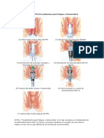 Pasos Del PPH