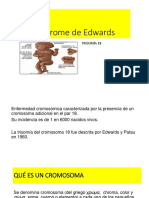 Síndrome de Edwards