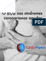 Ecg Nas SCA PDF