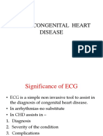 Ecg in Congenital Heart Disease