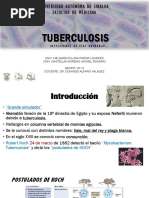 Tuberculosis