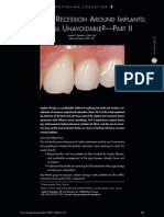 Soft Tissue Recession Around Implants